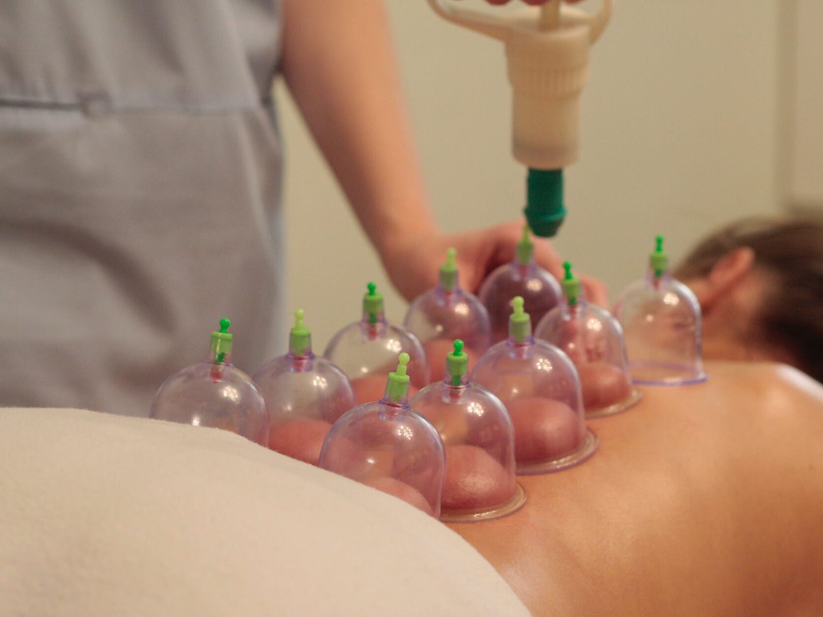 close up photo of a client undergoing ventoza treatment